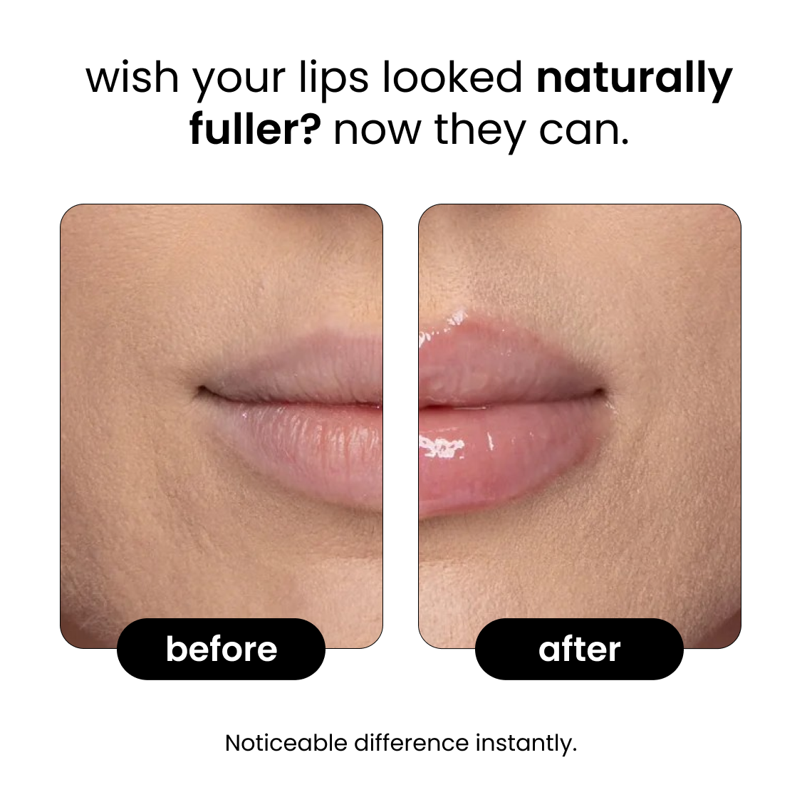 Astrea™ Lip plumper