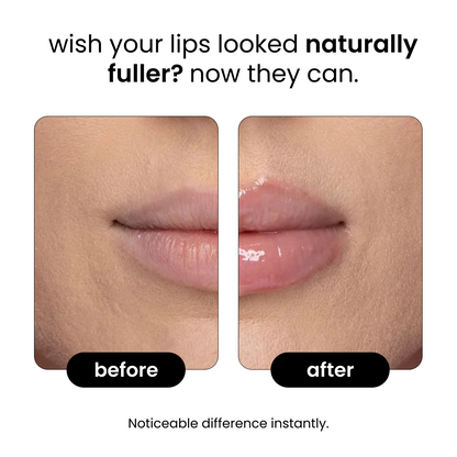 Astrea™ Lip plumper
